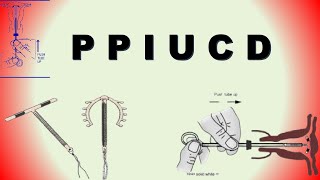 कोरबा: जिले में PPIUCD घोटाला, अधिकारी जवाबदेही से कन्नी काट रहे हैं?